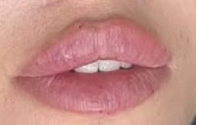 Lippenpfegetrends 2025