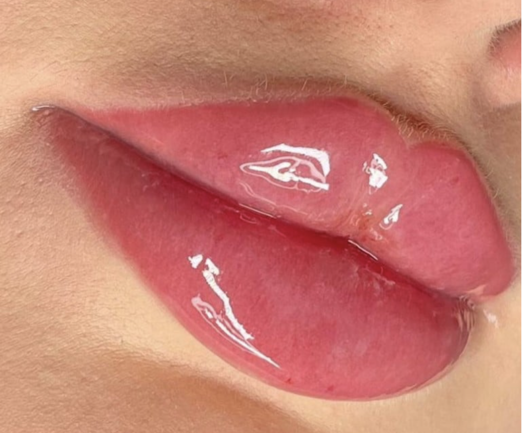 Russian Lips erklärt
