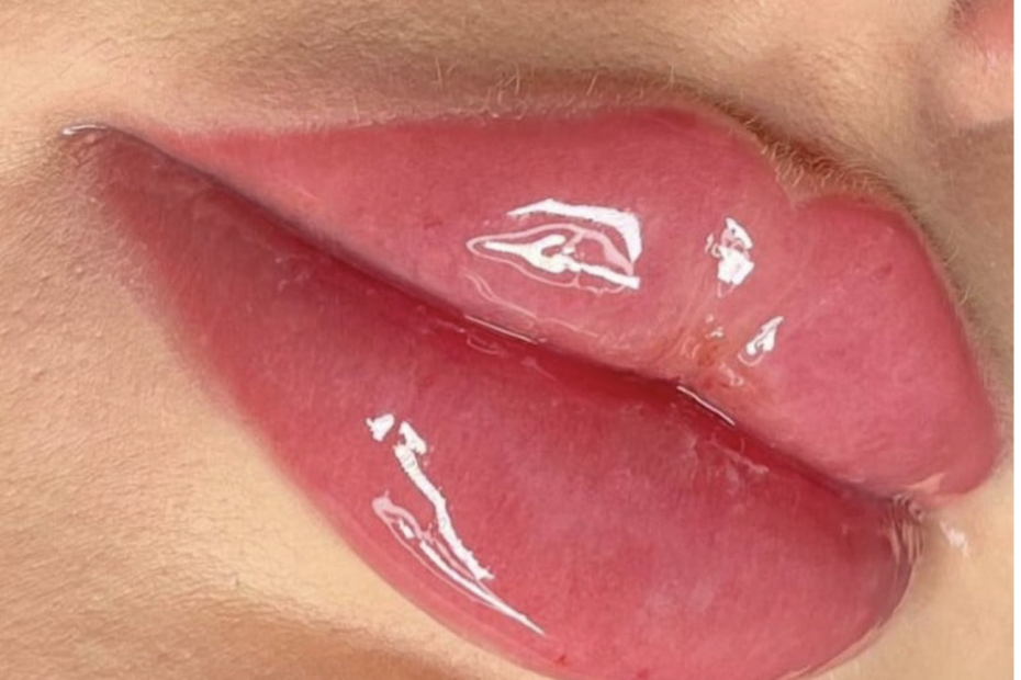 Russian Lips erklärt