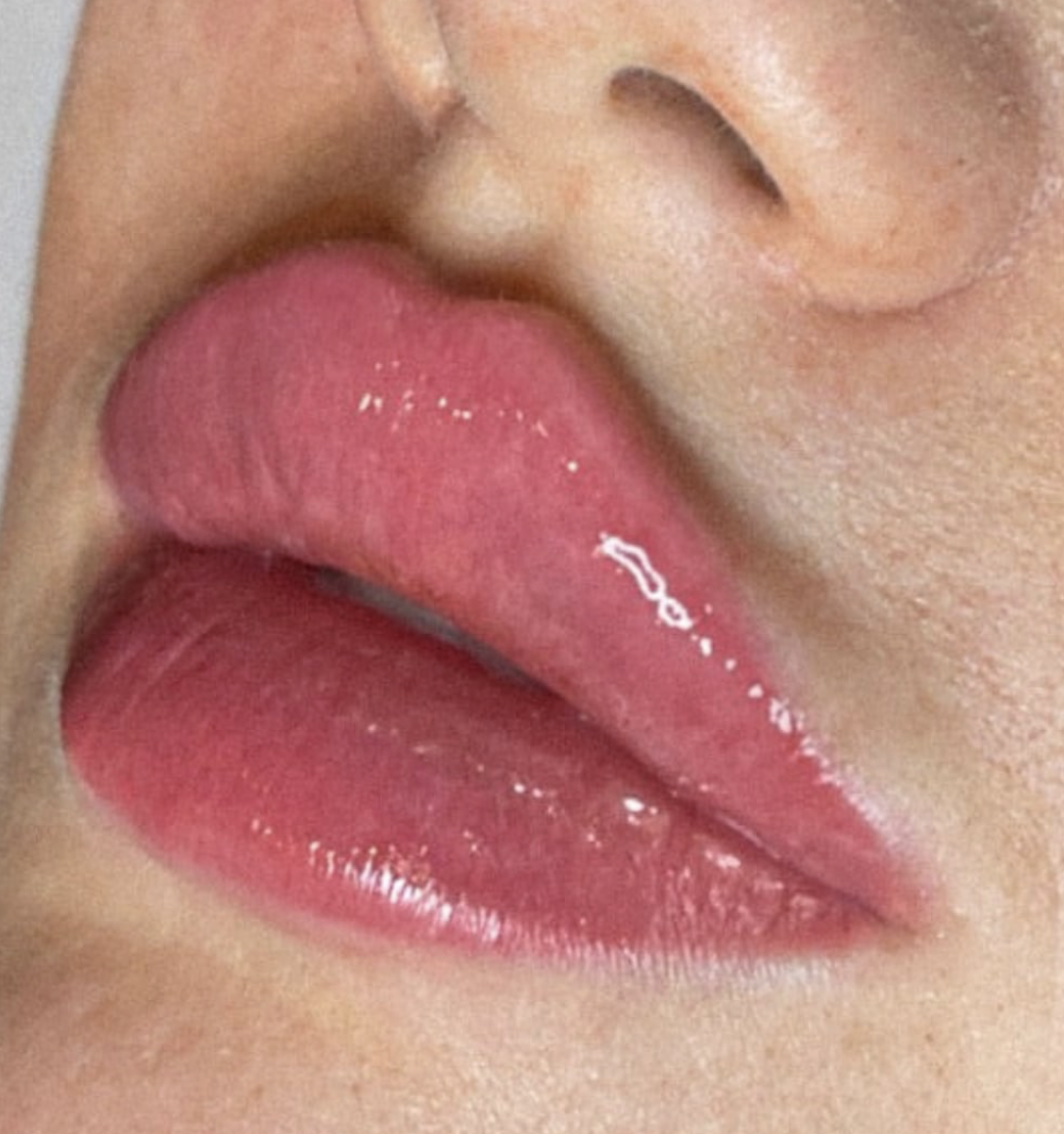 Russian Lips – Trend 2025