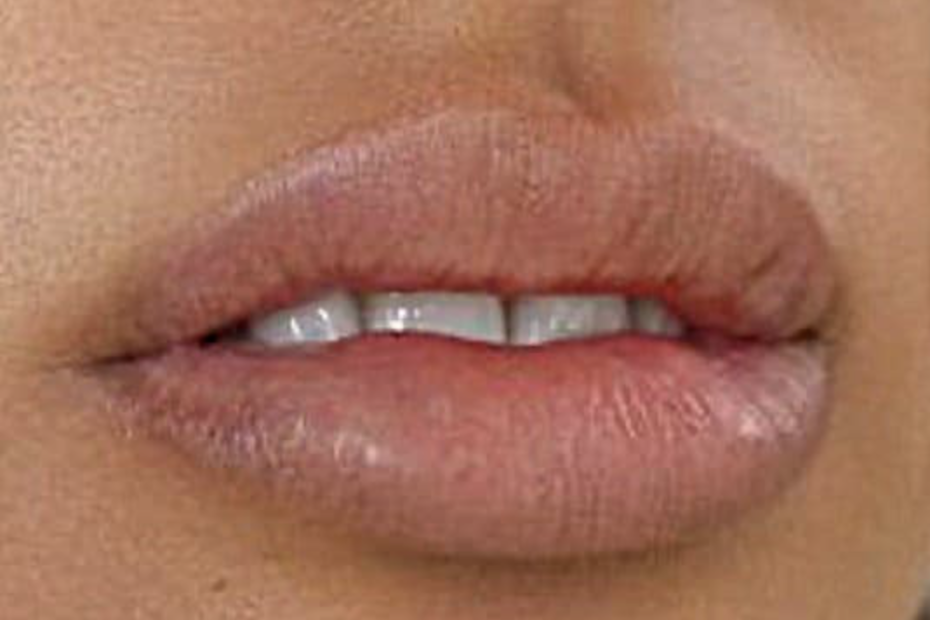Vitamine für schöne Lippen