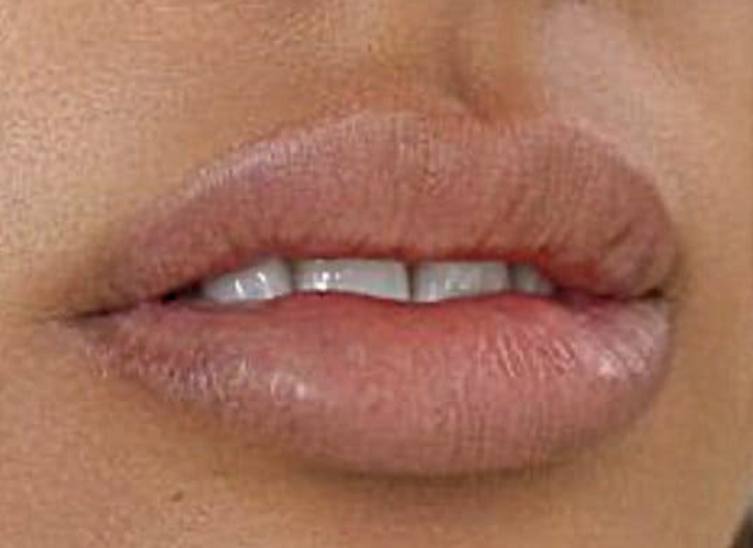 Vitamine für schöne Lippen